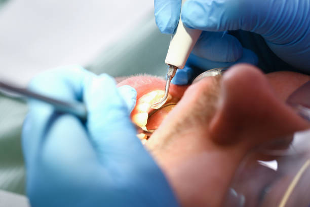 Best Pediatric Emergency Dentist in Ferndale, WA
