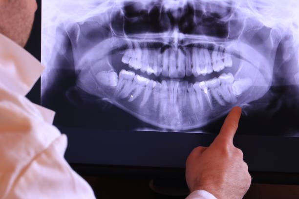 Best Walk-In Emergency Dentist in Ferndale, WA