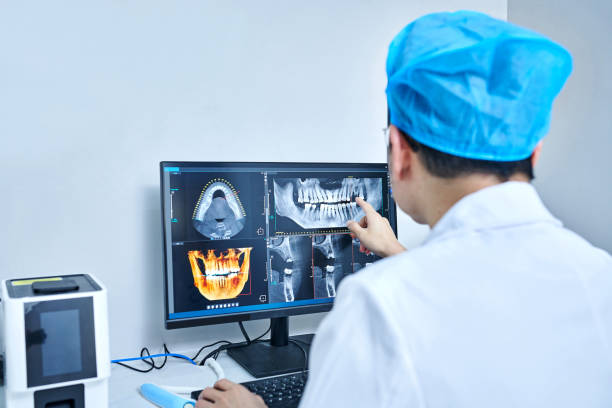 Best Emergency Tooth Extraction in Ferndale, WA