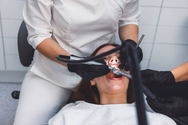 Best Emergency Wisdom Teeth Removal in Ferndale, WA